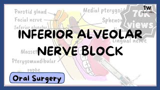 Inferior Alveolar Nerve Block Technique [upl. by Odnanreh]