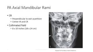 Radiographic Positioning of the Mandible [upl. by Vincentia]