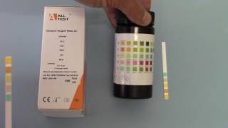 how to use a urine dipstick [upl. by Novonod]