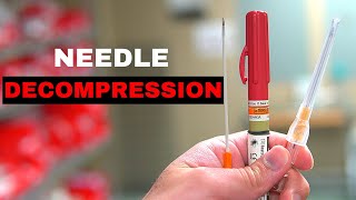 How To Chest Needle Decompression [upl. by Umeh890]