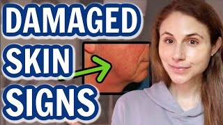 How to tell when your SKIN BARRIER IS DAMAGED Dr Dray [upl. by Aridni]