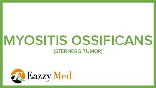 MYOSITIS OSSIFICANS STERNERS TUMOR [upl. by Gallagher]