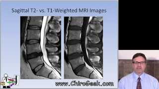 Dr Gillard lectures on How to Read Your Lumbar MRI [upl. by Lewis223]