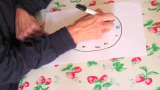 Clock drawing test dementia [upl. by Sicnarf]