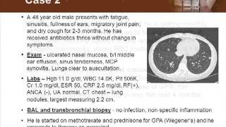 Primary Sclerosing Cholangitis Visual Explanation for Students [upl. by Elehcar]