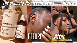 THE ORDINARY GLYCOLIC ACID 7 TONING SOLUTION  Indepth Review [upl. by Nile]