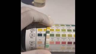 UTI dipstick test Urine Analysis [upl. by Yniar84]