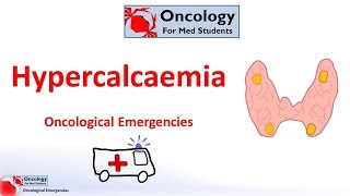 Hypercalcaemia of malignancy [upl. by Ax]