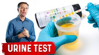 Urine Test Simplified [upl. by Maril634]