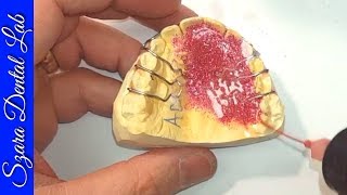 How retainers are made by Szara Dental [upl. by Anrapa]