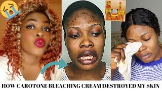 STORYTIME HOW CAROTONE BLEACHING CREAM DESTROYED MY SKIN😭😭 [upl. by Ecirual]