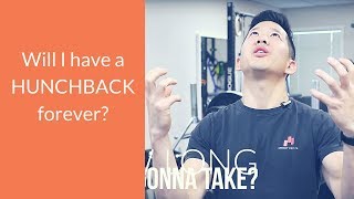 How long does it take to fix hunchback posture [upl. by Ahsila]