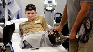 US soldier recovers after losing all four limbs [upl. by Ayaladnot]