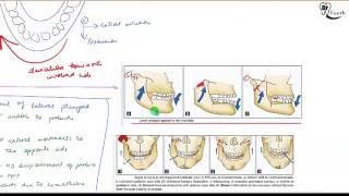 Condyle fracture Oral surgery [upl. by Nadoj]