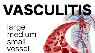 Vasculitis [upl. by Annirtak]