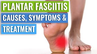 Plantar Fasciitis Causes Symptoms amp Treatment [upl. by Akinehc218]