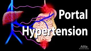 Portal Hypertension Animation [upl. by Egerton166]