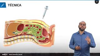 Paracentese  Aula de Procedimentos SanarFlix [upl. by Mirielle]