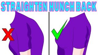 The 4 minute solution to correct hunchback kyphosis [upl. by Enihpled]