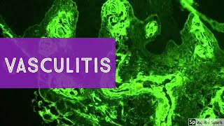 Granulomatosis with Polyangiitis pathophysiology symptoms treatment [upl. by Durston]