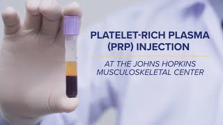 PlateletRich Plasma PRP Injections  QampA [upl. by Calvinna992]