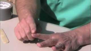 How to Remove a Mallet Finger Splint SAFELY [upl. by Dayle]