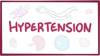 Hypertension Diagnosis and Treatment Options [upl. by Aylad]