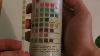 How to perform Urinalysis [upl. by Ellis]