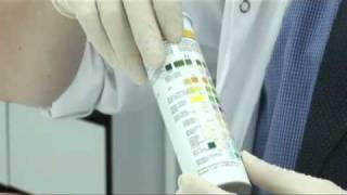 Urine Analysis [upl. by Noteloc]