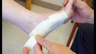 LowDye Strapping for Plantar Fasciitis [upl. by Rimidalb]