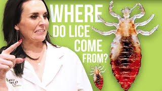 10 Facts You Dont Want to Know about Head Lice [upl. by Elman420]