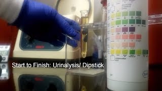 How to Urine Urinalysis Dipstick Lab Test [upl. by Edmanda]