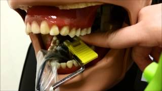 Mandibular Posterior Periapical Technique [upl. by Conant345]