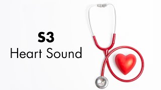 S3 Heart Sound  MEDZCOOL [upl. by Acilegna]