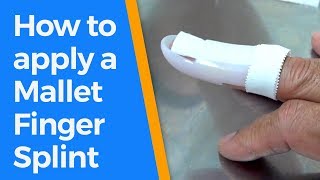 How to splint a mallet fingerfinger splints [upl. by Lasky578]