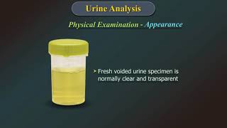 Urine Analysis [upl. by Nedda]