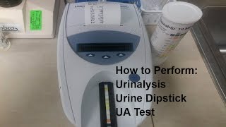 How to Perform a Urine Dipstick Test [upl. by Boot427]