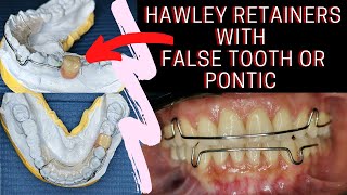 Hawley RETAINERS with FALSE TOOTH or Pontic  PHILIPPINES [upl. by Lalla474]