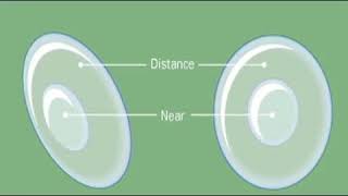 How Do Bifocal Soft Contact Lenses Work [upl. by Onairda655]