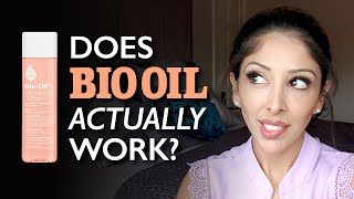 BIO OIL Review by DOCTOR V Brown Dark skin  stretch marks pigmentation how to use DR V SOC [upl. by Richers236]