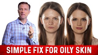 How To Fix Oily Skin With Simple Hack – Dr Berg [upl. by Stevie]