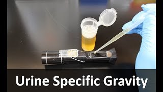 Urine Specific Gravity Refractometer [upl. by Yelkreb]