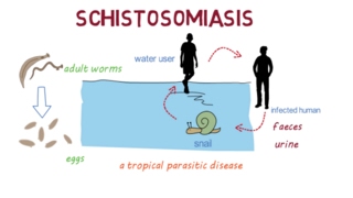 Schistosomiasis Bilharzia– an overview [upl. by Reace951]