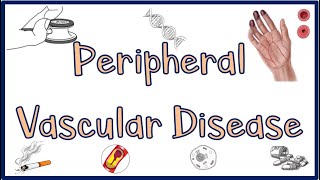 Peripheral Vascular DiseasePVD Causes Signs amp Symptoms Diagnosis ampTreatment [upl. by Ali]