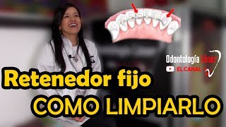 RETENEDOR FIJO  Como limpiarlo  Odontología Láser [upl. by Tra]