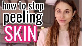 How to STOP PEELING SKIN Dr Dray [upl. by Karoline]