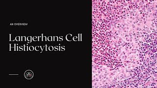 What is Langerhans Cell Histiocytosis [upl. by Seltzer]