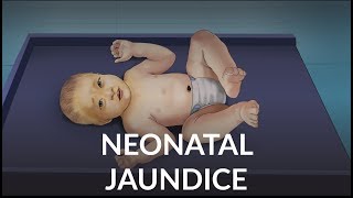 Neonatal Jaundice by L Veit  OPENPediatrics [upl. by Eilatam]