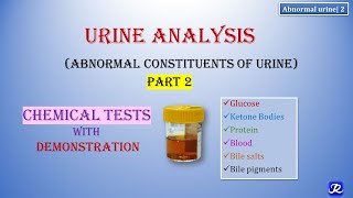 2 Abnormal Urine  Part 2  Urine Analysis  Chemical Tests  Biochemistry  NJOY Biochemistry [upl. by Corinne]