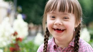 Down Syndrome in the 21st Century [upl. by Hna]